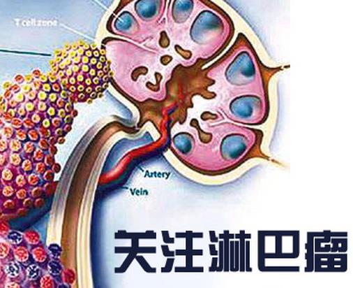 世界十大痛苦癌癥排行，胃癌發病率高，肺癌死亡率最快